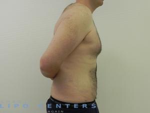 americanlipocenters_110.jpg